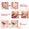 SUNMAY VSkin Microcurrent Face Lift Device skin improvement before and after